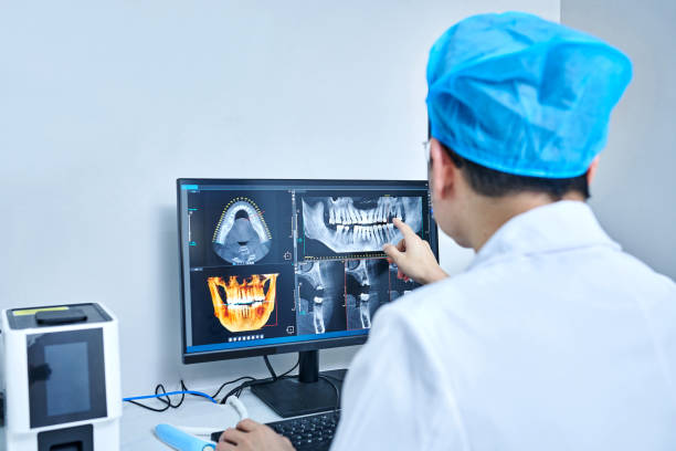 Best Knocked-Out Tooth (Avulsed Tooth) Treatment in Topanga, CA